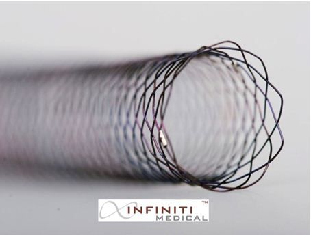 Nitinol stent